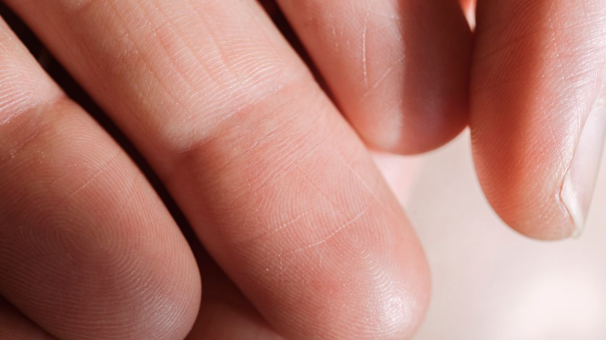Fingerprint Sensors Fail When Skin Oil Fills the Ridges